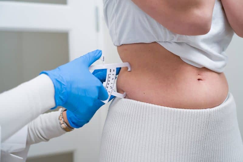 Op welke manieren kun je afvallen? | RB Clinics Amsterdam
