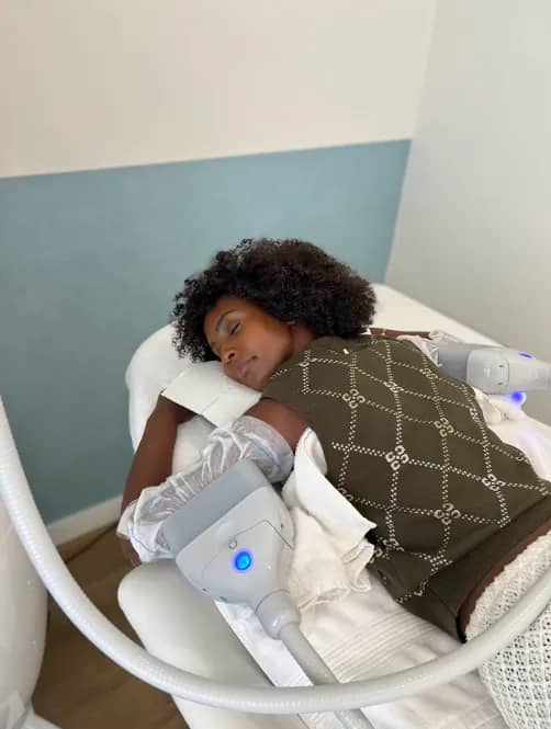 Cryolipolysebehandeling van beide bovenarmen bij RB Clinics