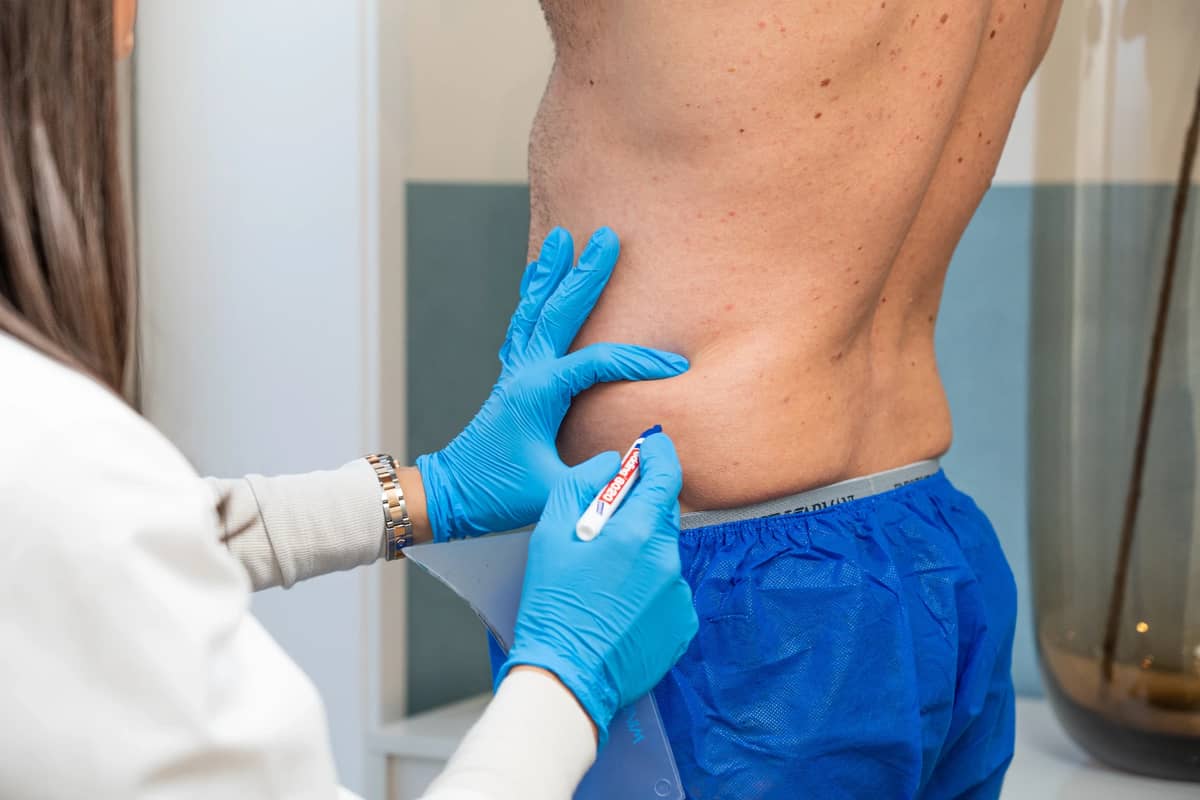 Specialist beoordeelt de rugzone voor een vetbevriesbehandeling bij RB Clinics